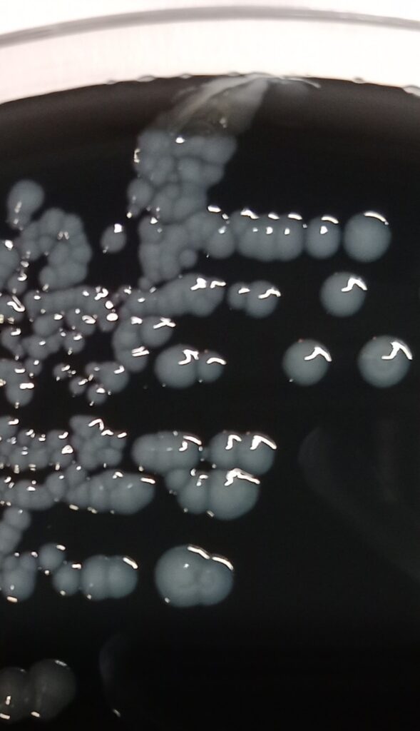 Inicio aislamiento legionella pneumophila