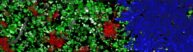 biofilm